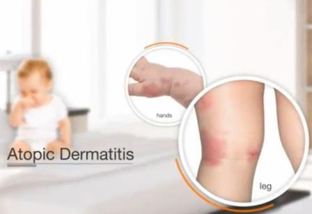 Dustmites Terminator